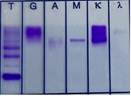 A close-up of a test

Description automatically generated