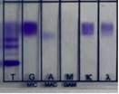 A test results of a dna sample

Description automatically generated with medium confidence