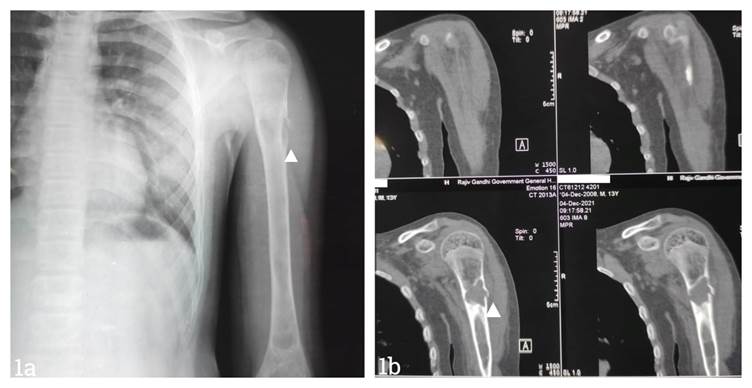 A close-up of x-ray images

Description automatically generated