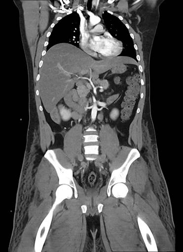 An x-ray of a body

Description automatically generated